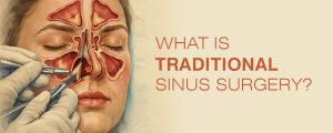 What Is Traditional Sinus Surgery?