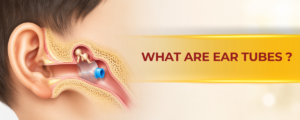WHAT ARE EAR TUBES (GROMMETS)?