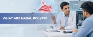 WHAT ARE NASAL POLYPS?