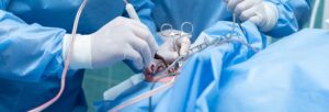 Endoscopic Surgery vs Open Surgery: Which E.N.T. Procedures Have Changed?